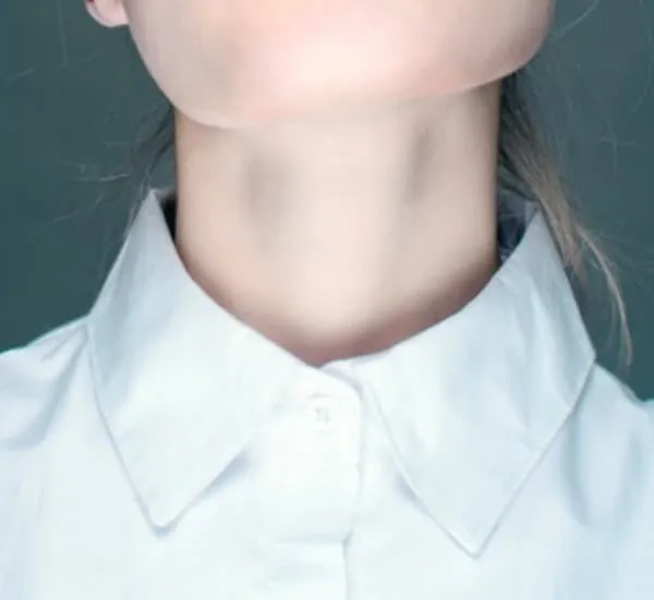 Neck and throat